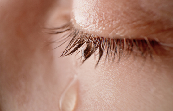 후천성 눈물길 폐쇄 이미지